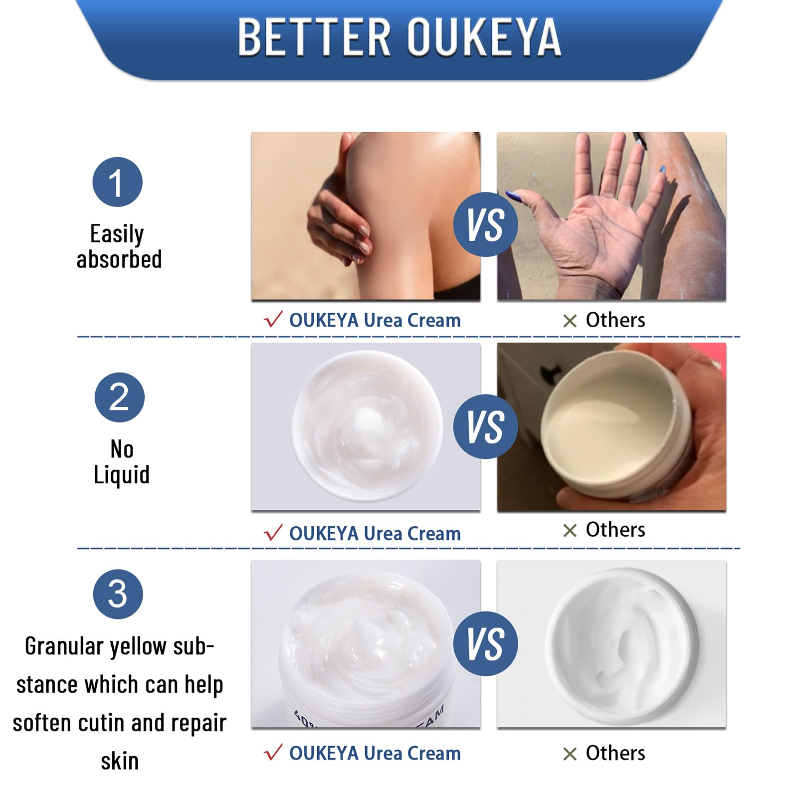 OUKEYA Urea Cream foot care focus supports soft, comfortable steps.