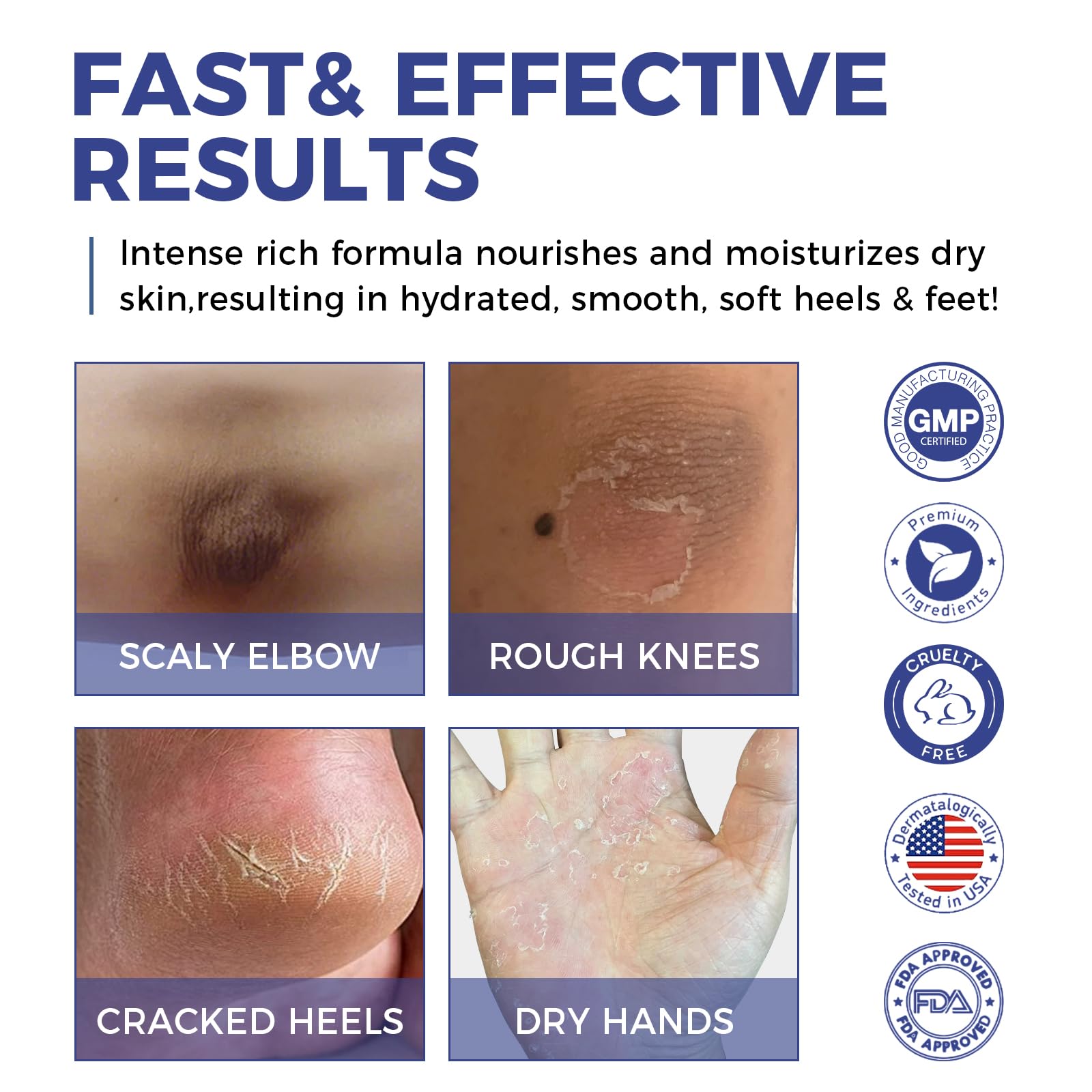 OUKEYA Urea Cream quickly absorbs without greasiness for busy routines.