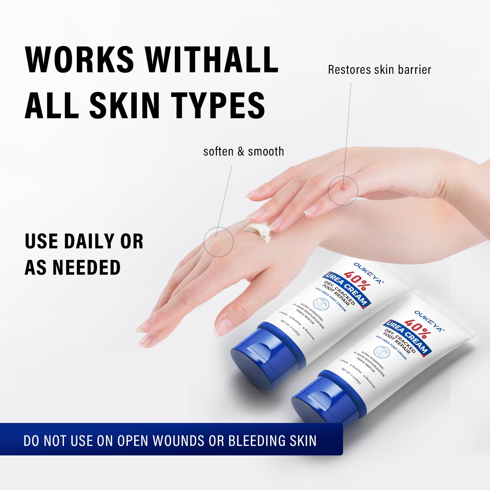 OUKEYA urea cream daily-use routine on hands closeup.