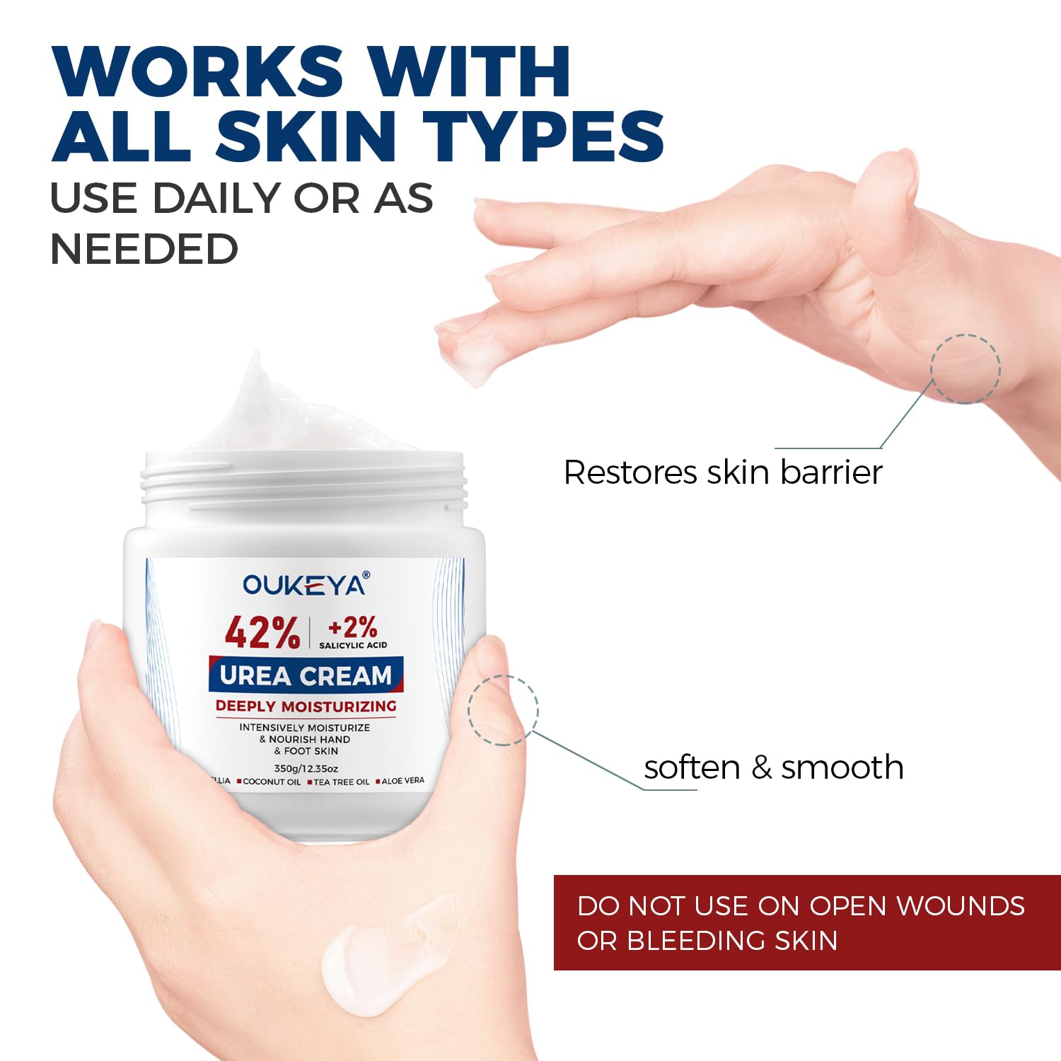 OUKEYA Urea Cream 42% applying to calloused feet for thick skin reduction.