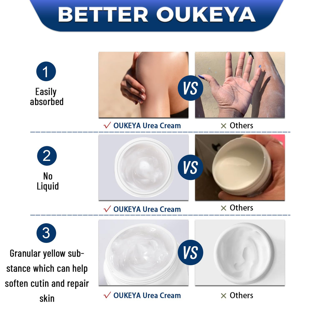 OUKEYA Urea Cream 42% softening rough patches on elbows and knees.