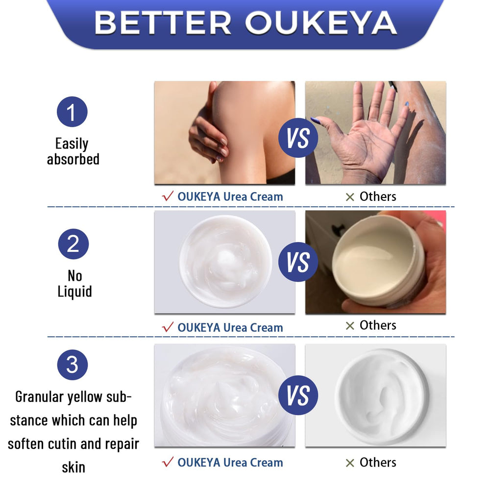 OUKEYA Urea Cream helps elbows and knees look smoother with regular use.