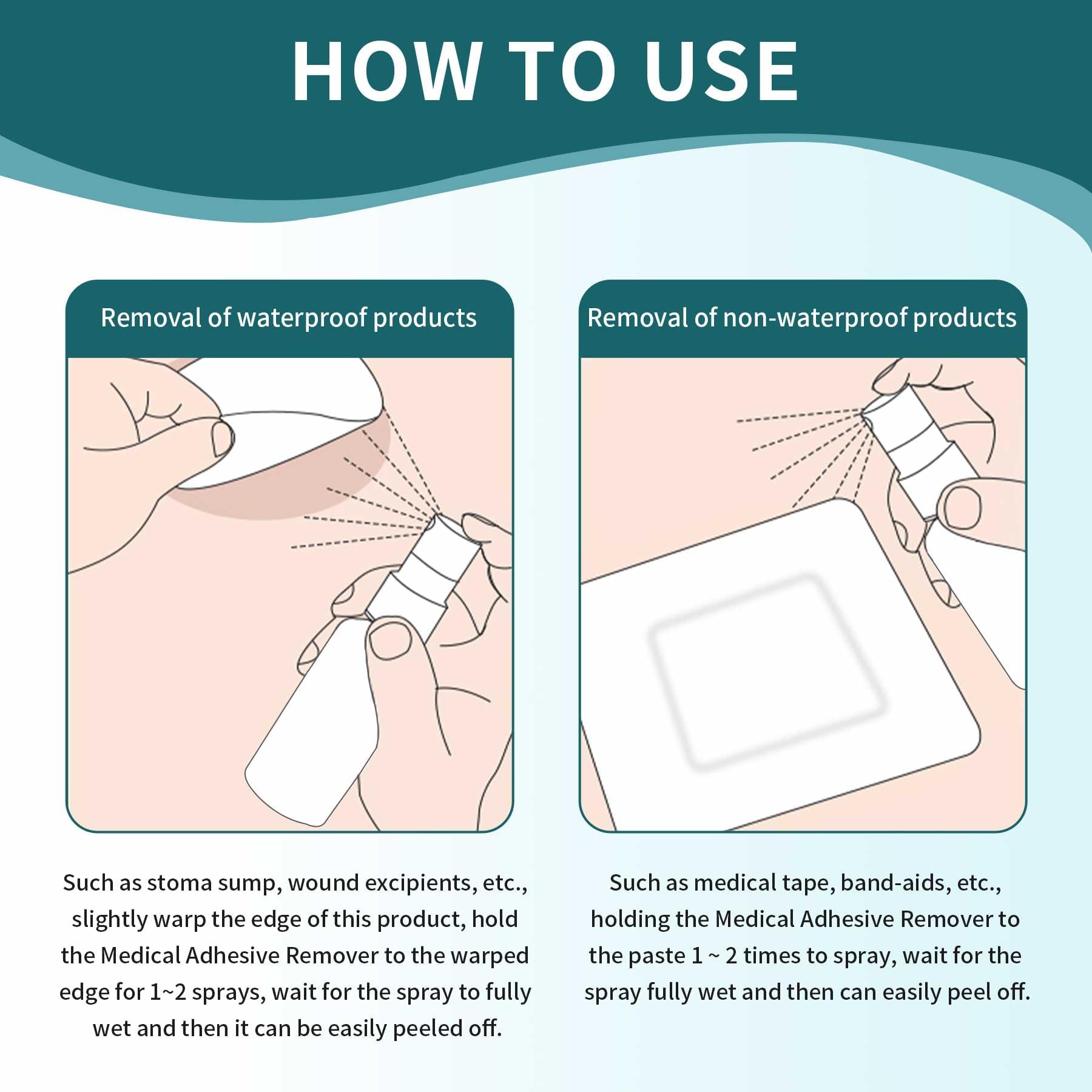 Ovand ostomy adhesive remover spray label highlights ostomy-care routines.