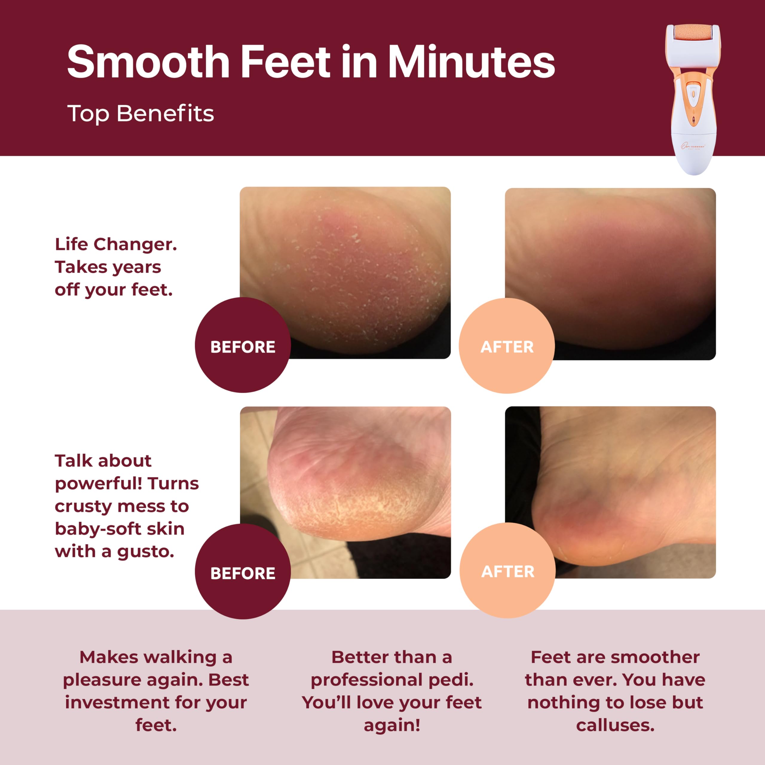 CR900 roller heads offering versatile smoothing for different callus levels