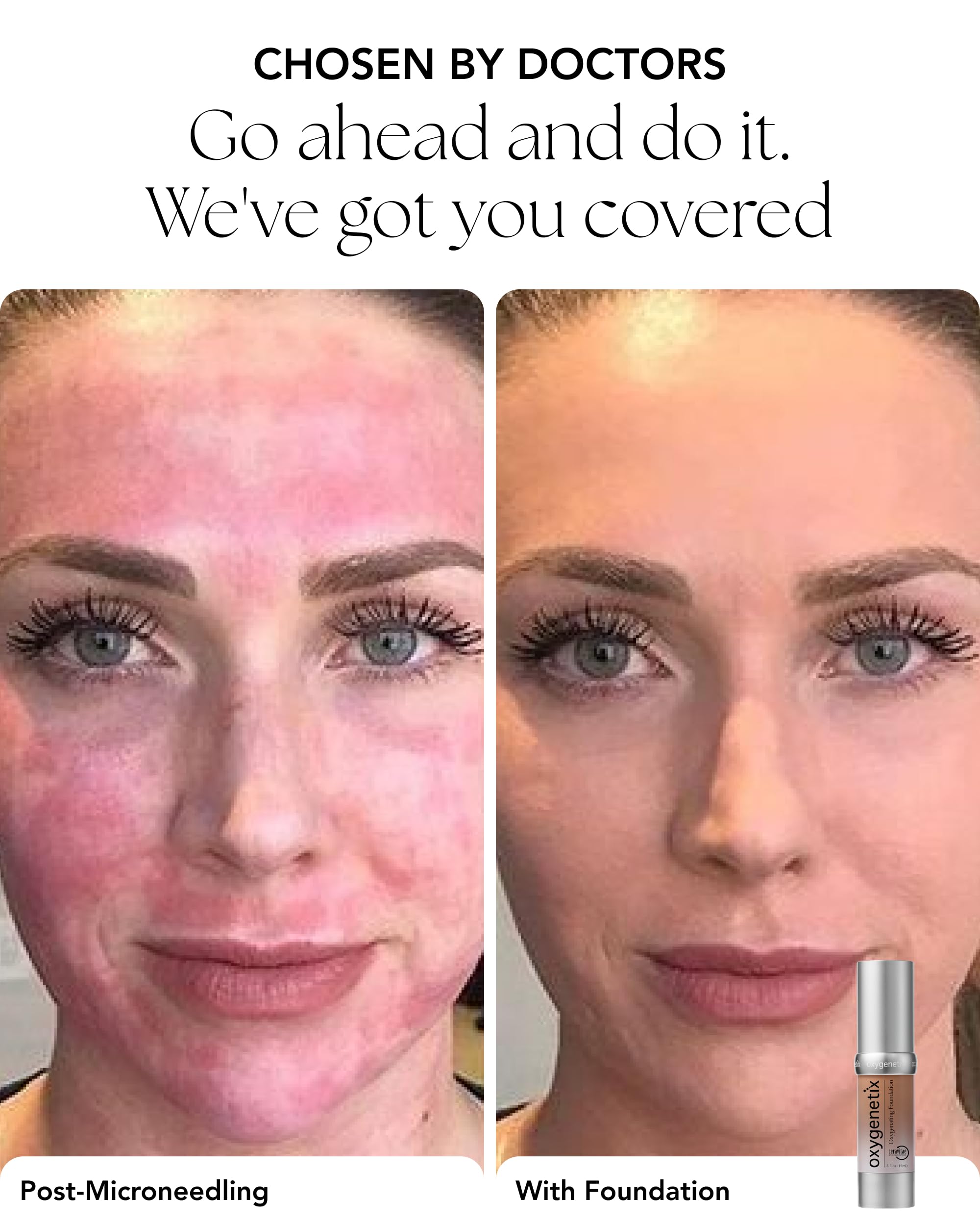 Oxygenetix Oxygenating Foundation Pearl being dabbed onto skin to show buildable coverage.
