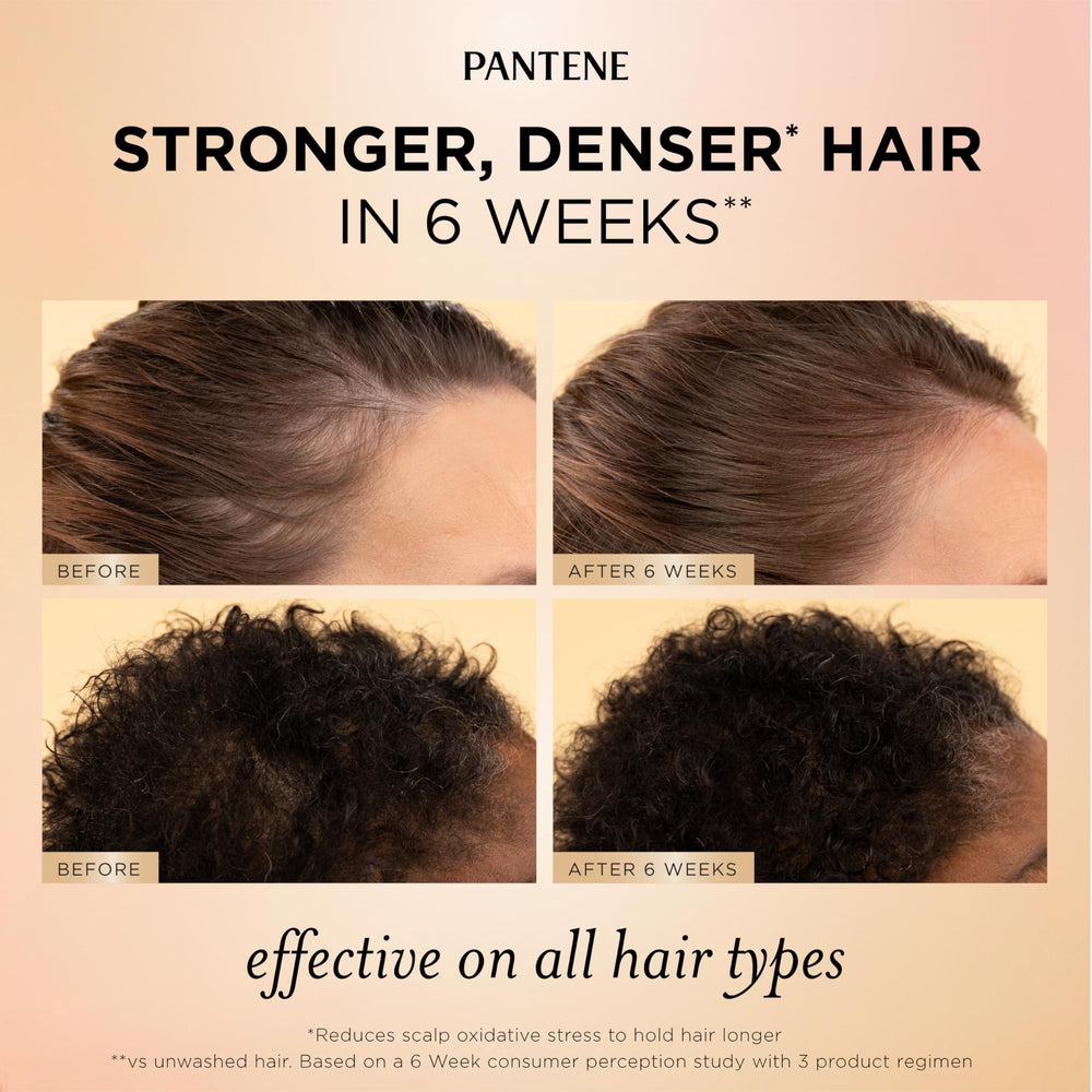 Pantene applying serum to scalp demonstrating targeted root nourishment benefit