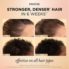 Pantene applying serum to scalp demonstrating targeted root nourishment benefit