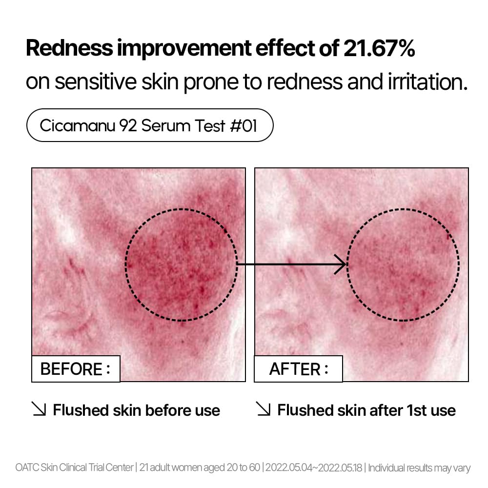 Parnell Cicamanu 92 Serum gel texture melts into skin.