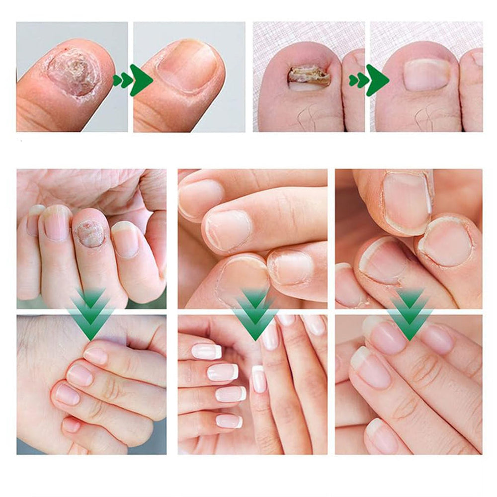 PARWENE application on nails demonstrating easy daily use