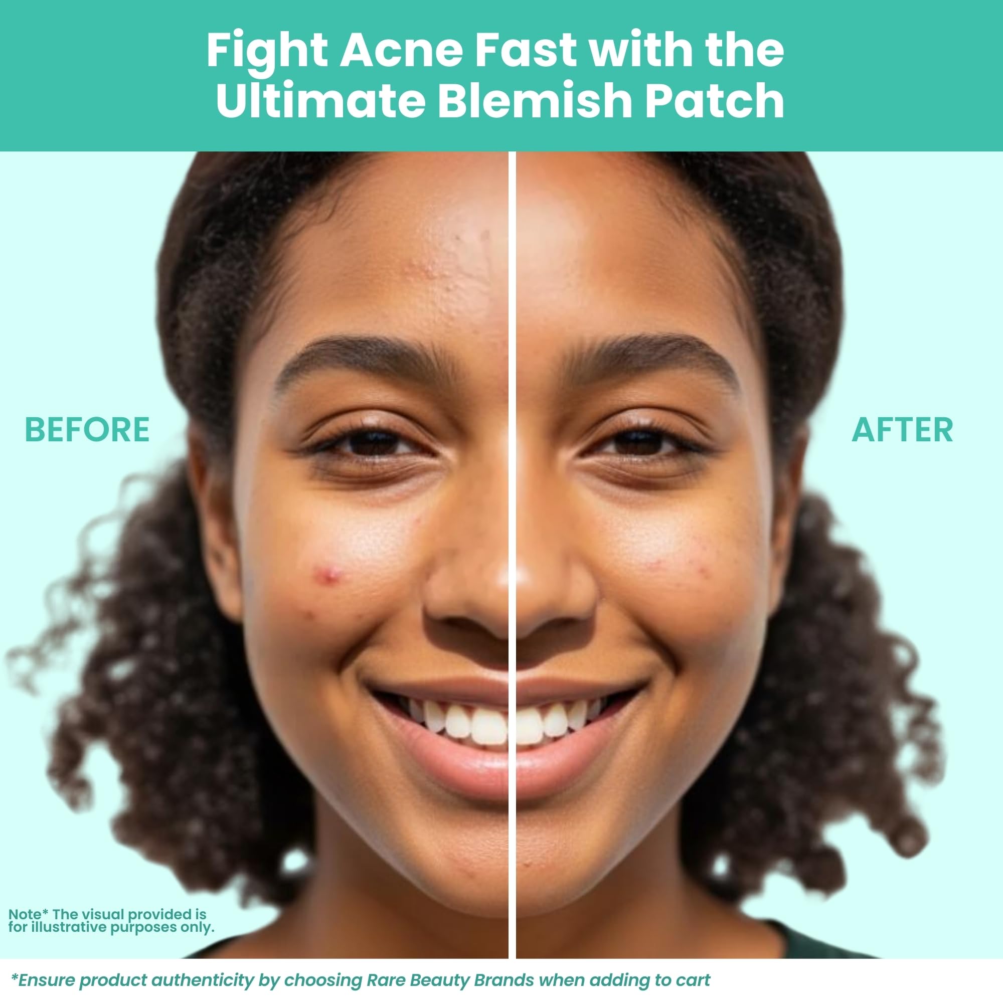 Patchology Breakout Box ingredients panel highlights salicylic acid and tea tree oil benefits