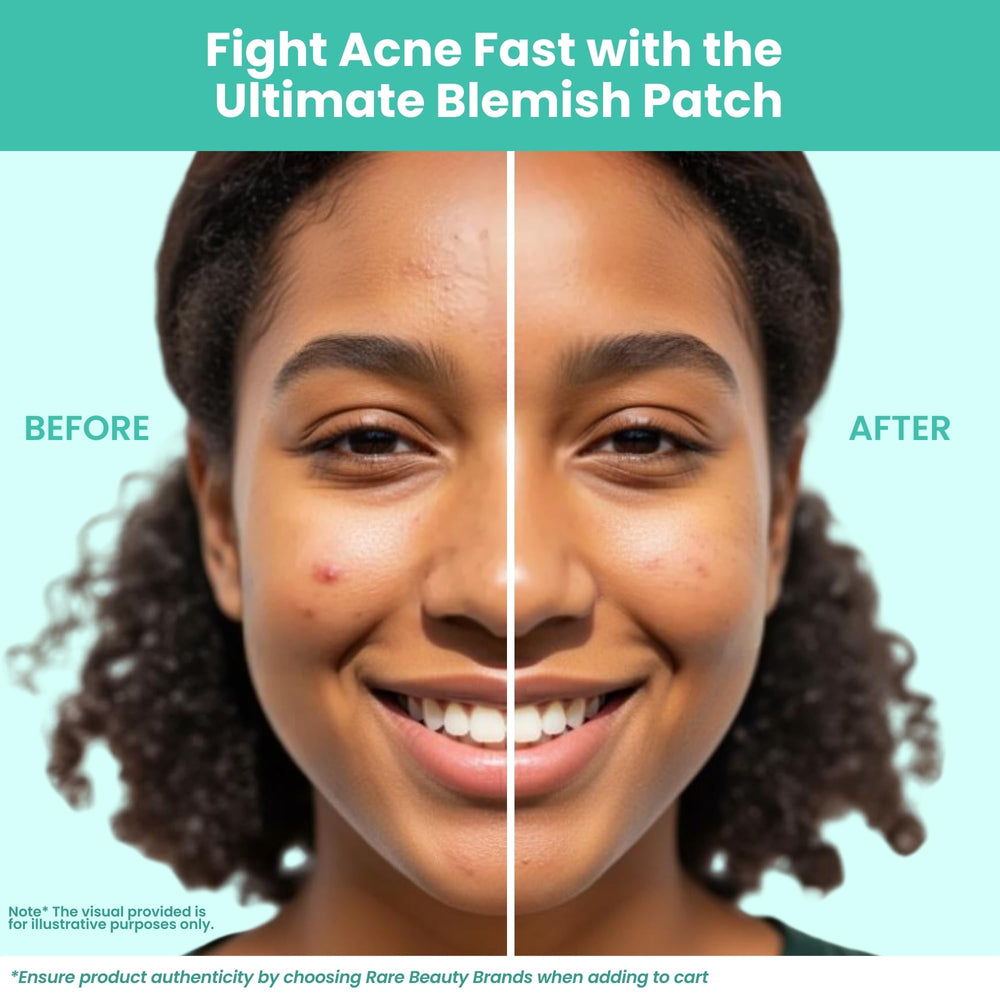 Patchology Breakout Box ingredients panel highlights salicylic acid and tea tree oil benefits
