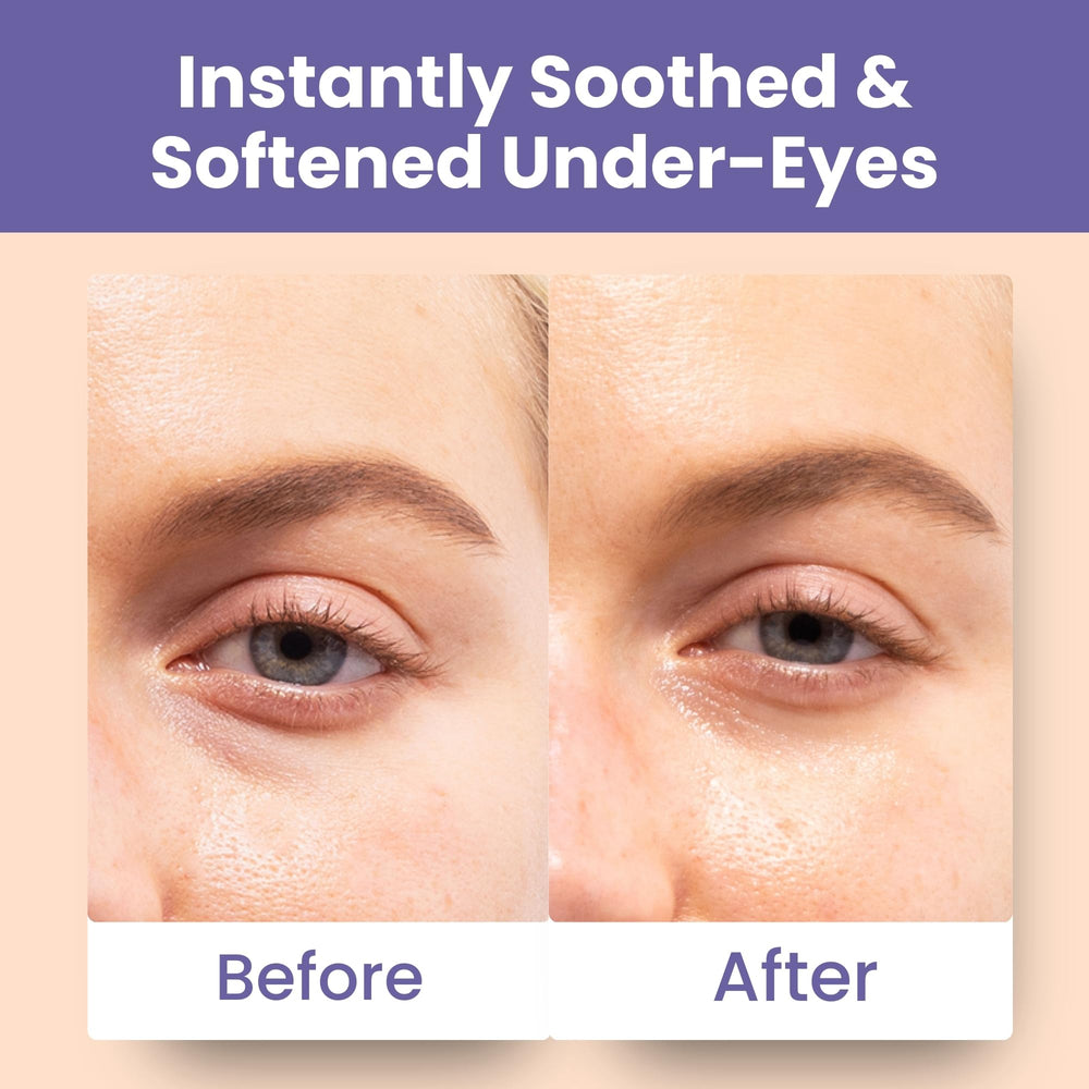 Patchology Skin Remedy Soothing Eye Gels hydrated-under-eye look reveals revived, moisturized under-eyes.
