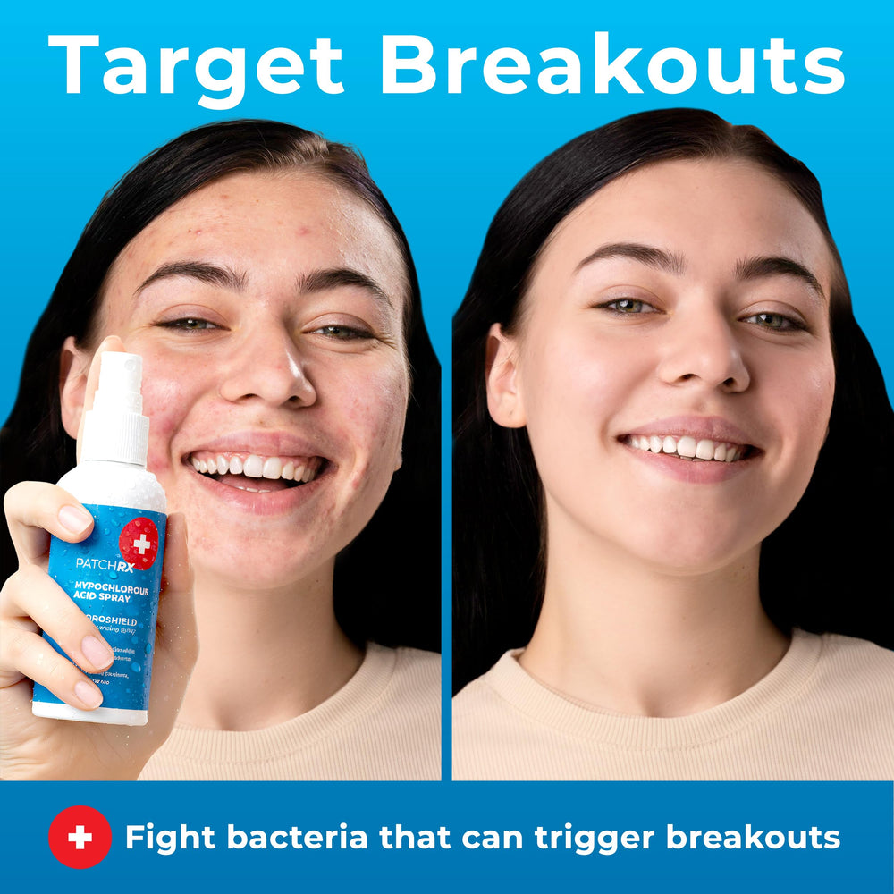 PatchRx Hypochlorous Acid Spray applied to the face for refreshing, calm skin.