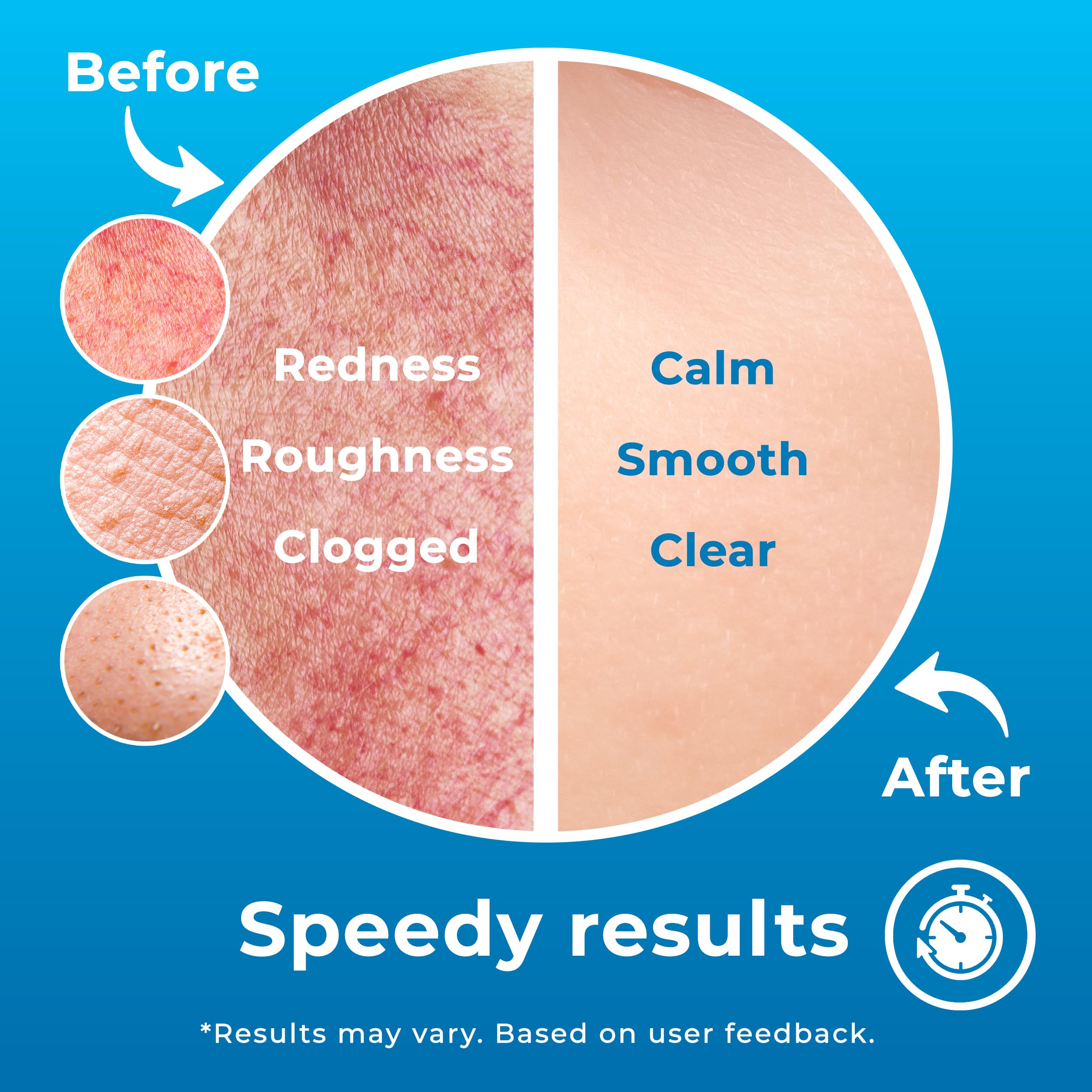 PatchRx HOCL spray label close-up emphasizing non-drying formula.