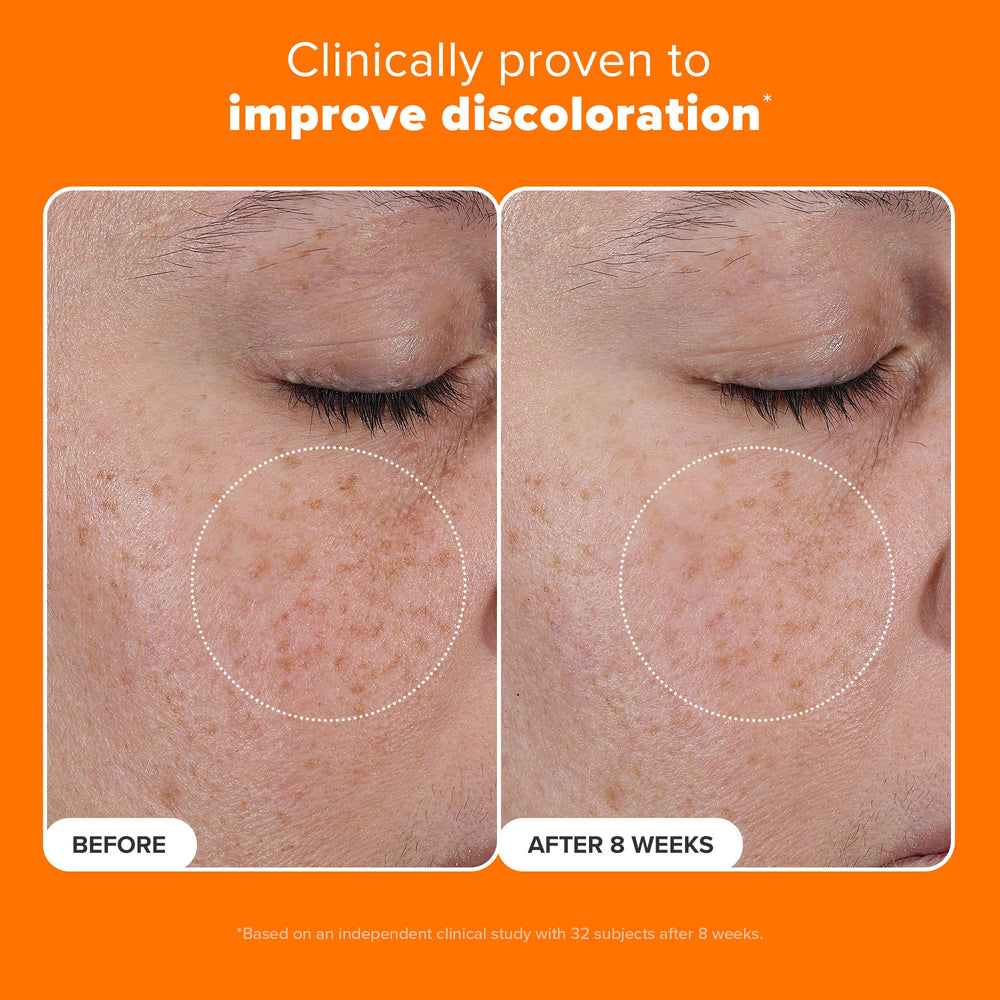 Paula's Choice 25% Vitamin C serum even-tone close-up shows radiant, more even skin