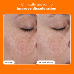 Paula's Choice 25% Vitamin C serum even-tone close-up shows radiant, more even skin