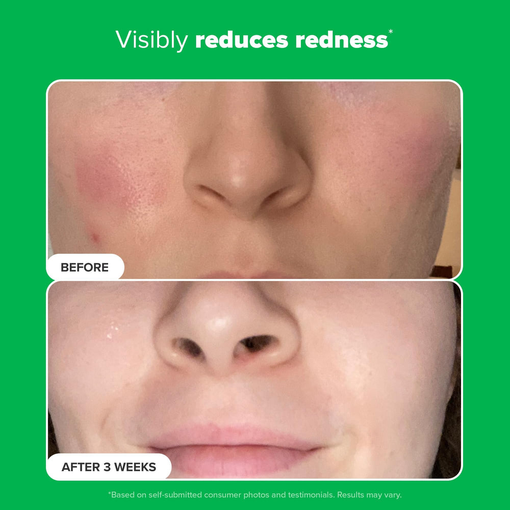 Paula's Choice travel-size packaging shown for on-the-go skincare.