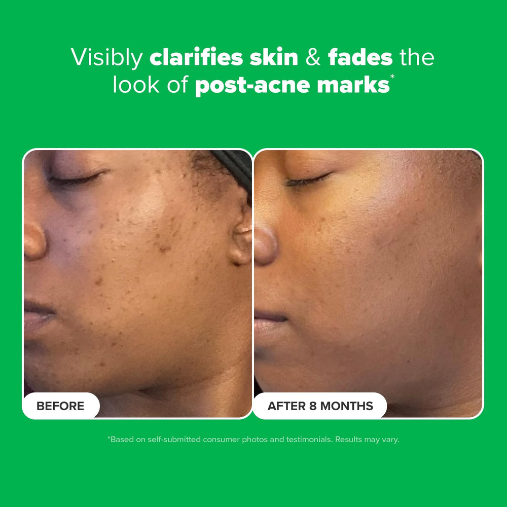 Paula's Choice Boost Azelaic Acid Booster close-up shows clear gel texture ideal for layering.