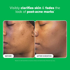 Paula's Choice Boost Azelaic Acid Booster close-up shows clear gel texture ideal for layering.