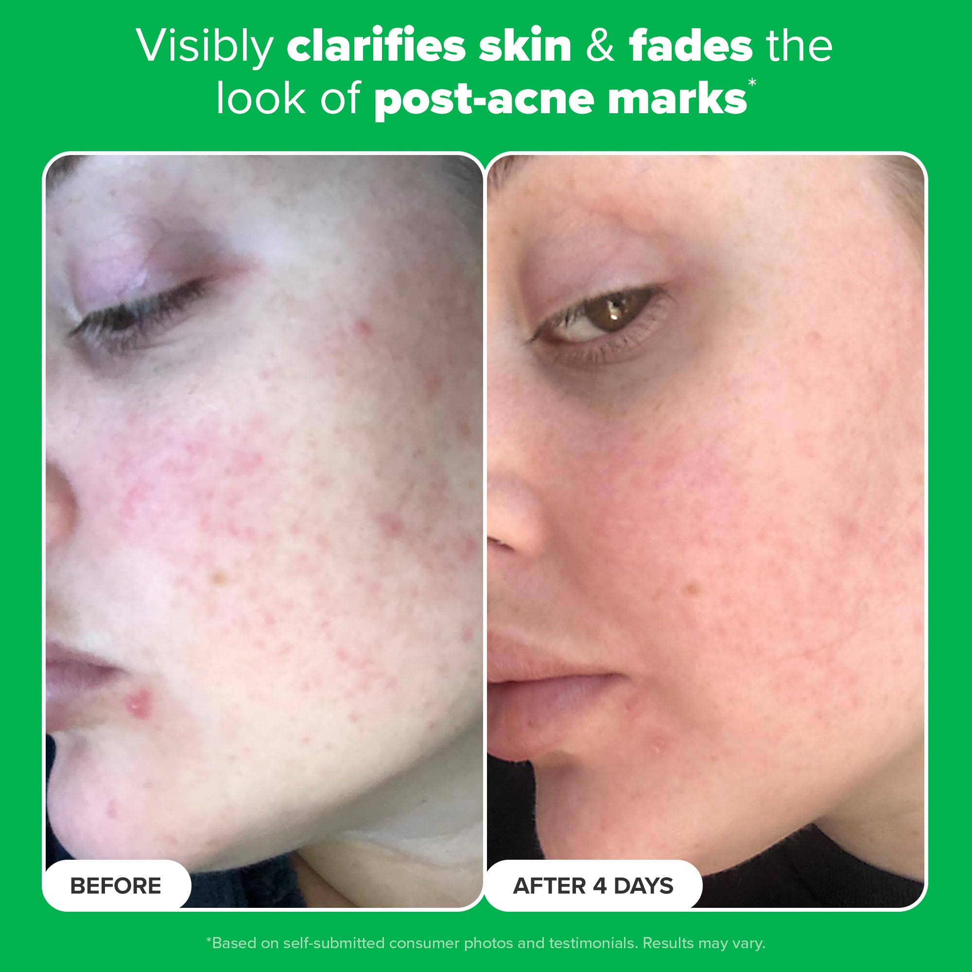Paula's Choice Boost Azelaic Acid Booster fragrance-free label signals clean, irritation-friendly skincare.