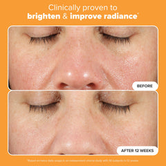 Paula's Choice BOOST C15 serum application on skin for even tone