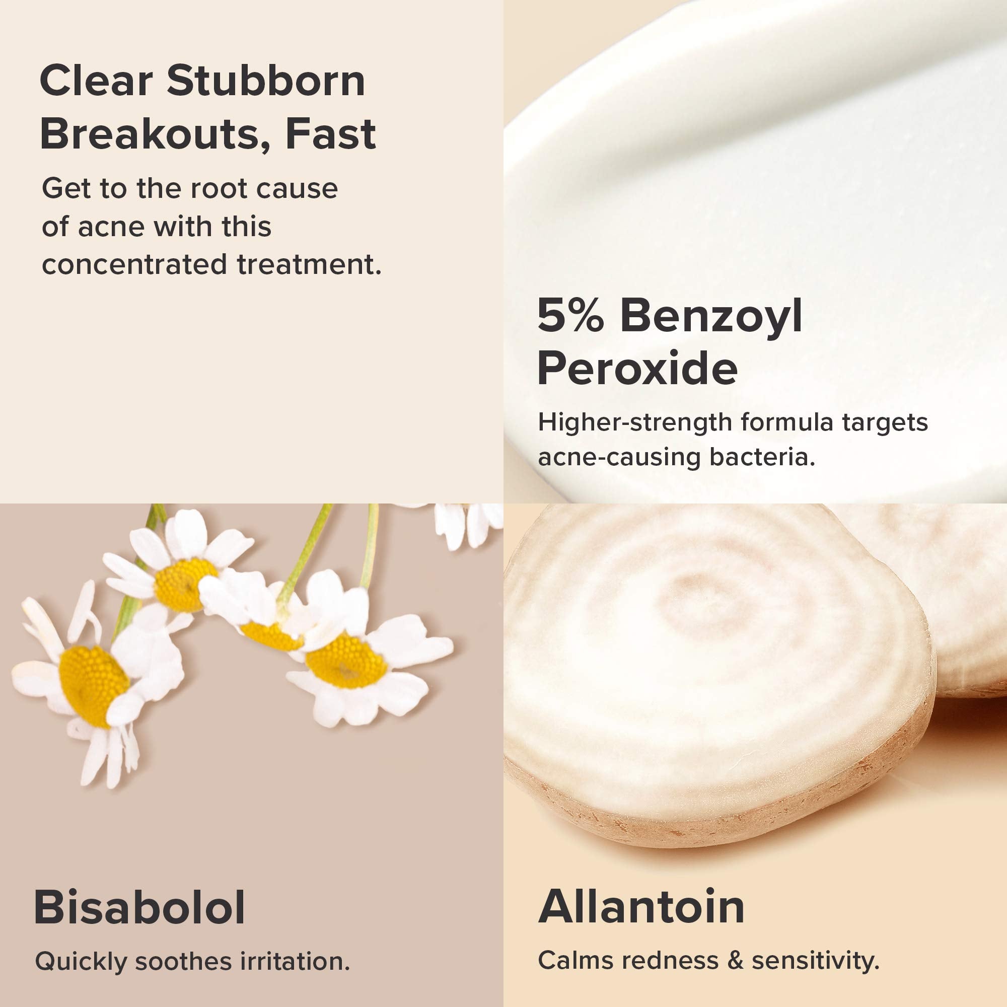Paula's Choice CLEAR benzoyl peroxide action highlights battling existing breakouts