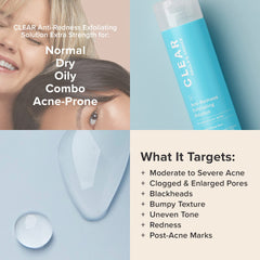 Paula's Choice label highlights 2% salicylic acid for acne-prone skin