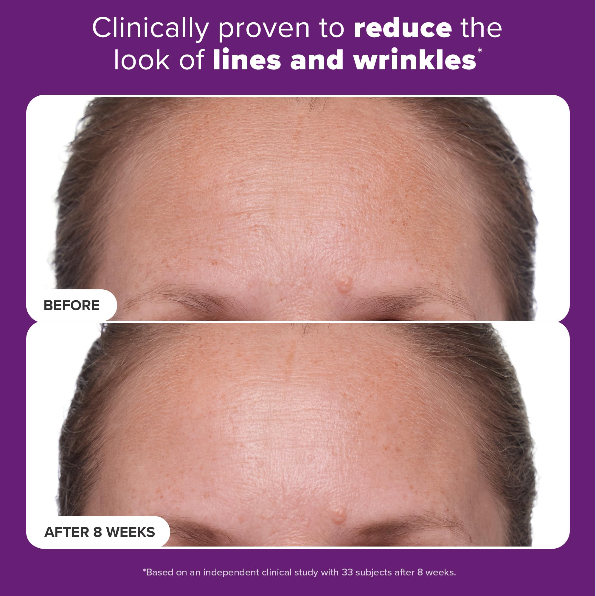 Paula's Choice Clinical 1% Retinol with hyaluronic acid illustrating hydration support