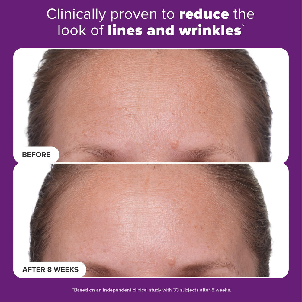 Paula's Choice Clinical 1% Retinol with hyaluronic acid illustrating hydration support