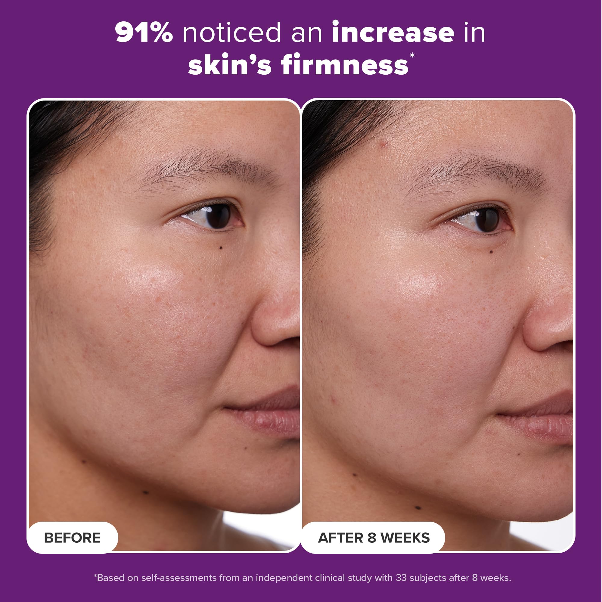 Paula's Choice Clinical 1% Retinol packaging variation showcases sustainable packaging