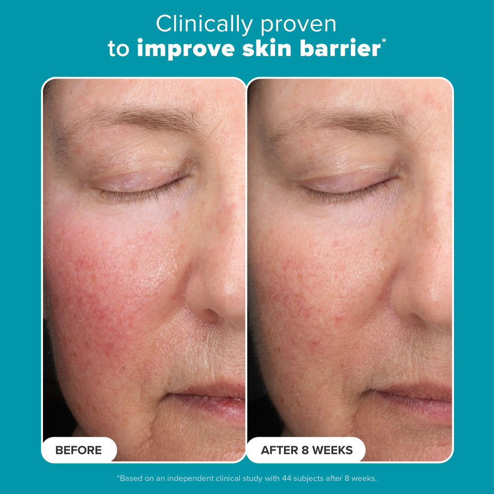 Skin close-up after use — brighter, more even tone with Paula's Choice