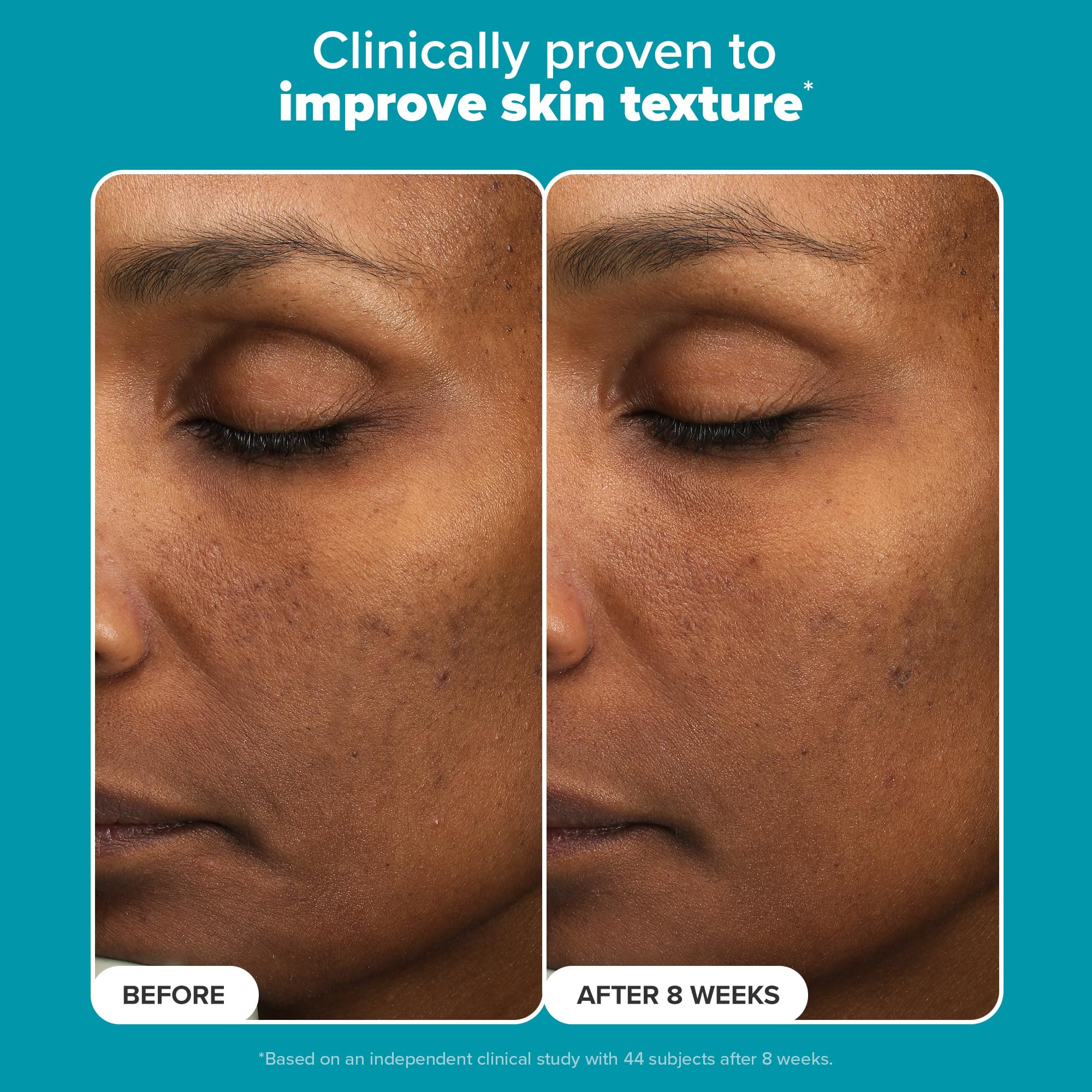 Texture swatch of Paula's Choice exfoliant — dissolves dead skin cells