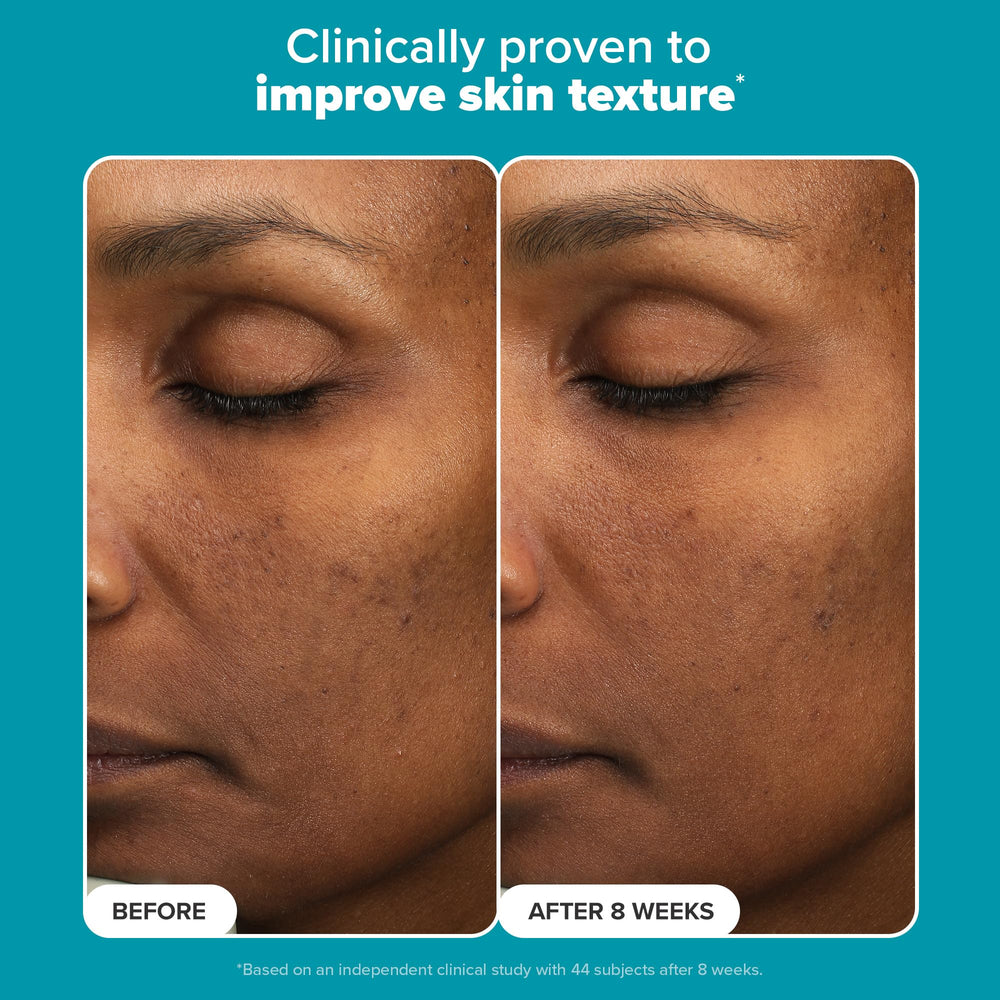 Texture swatch of Paula's Choice exfoliant — dissolves dead skin cells