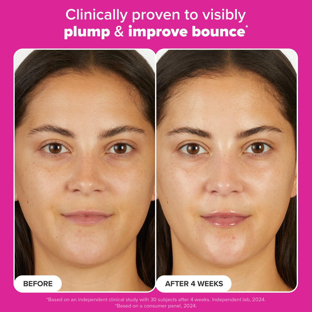 Closeup of skin with plump appearance after applying peptide moisturizer