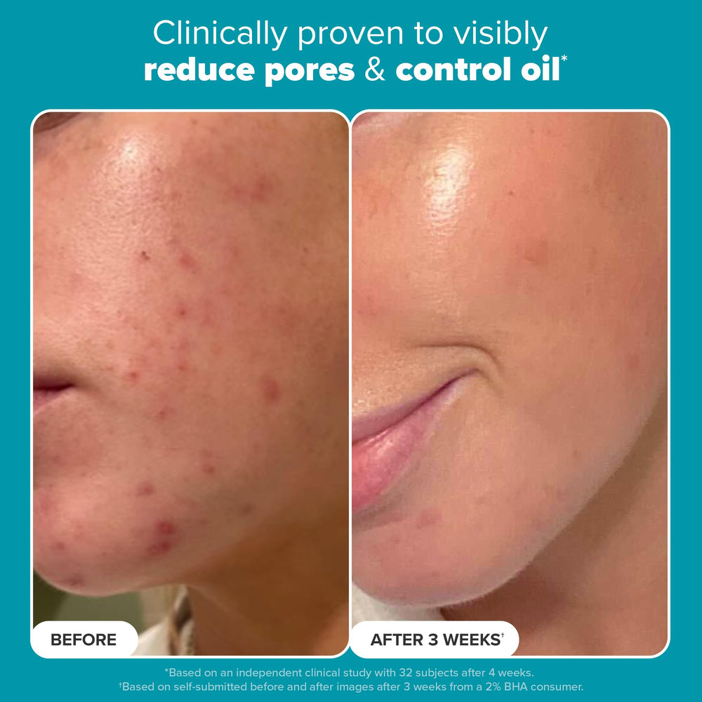 Paula's Choice 2% BHA pores smoothing visual helping refine pores