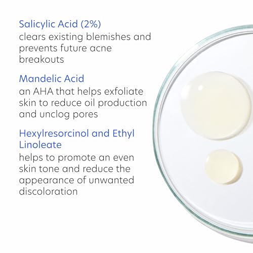 PCA SKIN Acne Gel texture on skin highlights oil control benefits.