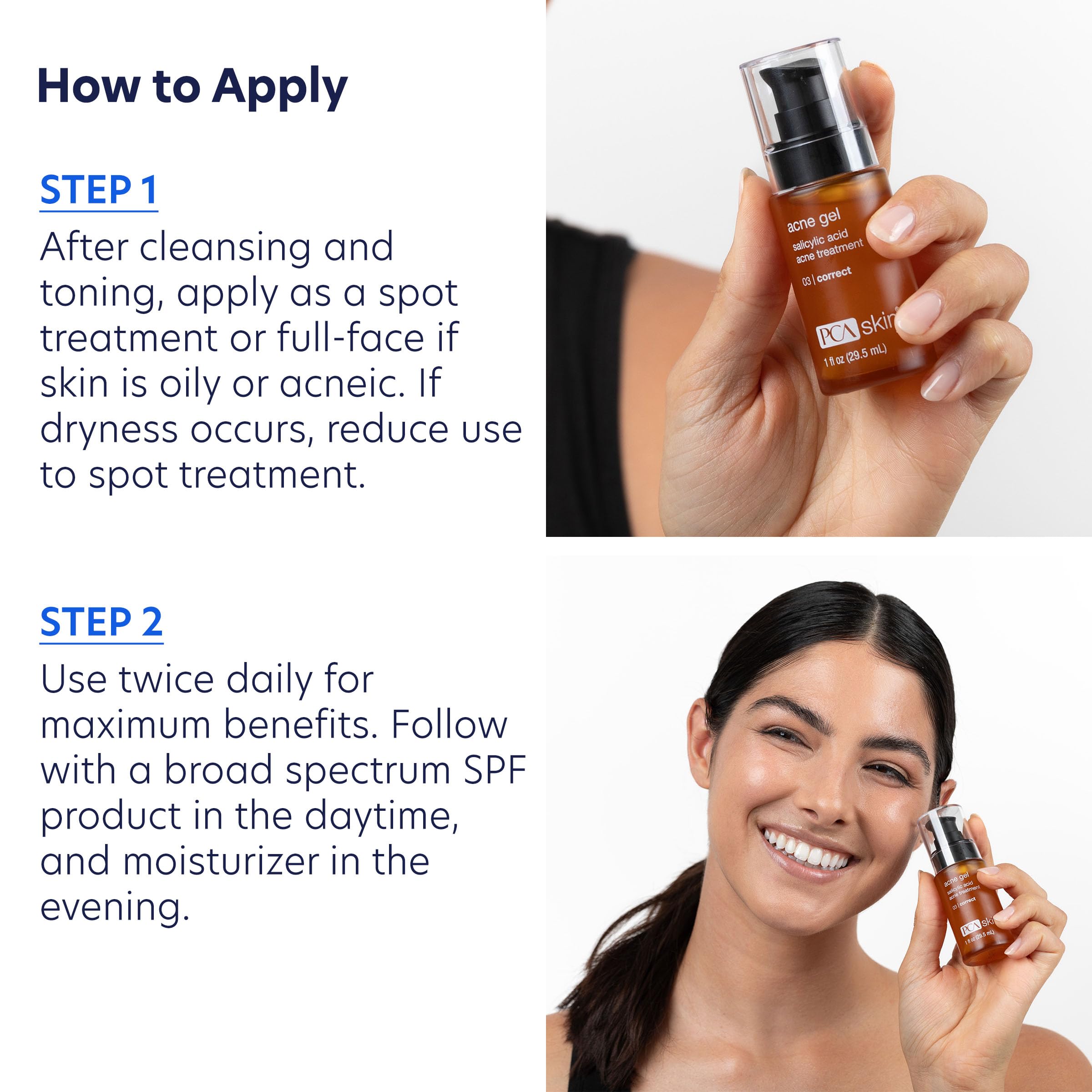 PCA SKIN Acne Gel applied to a blemish demonstrates targeted spot treatment.