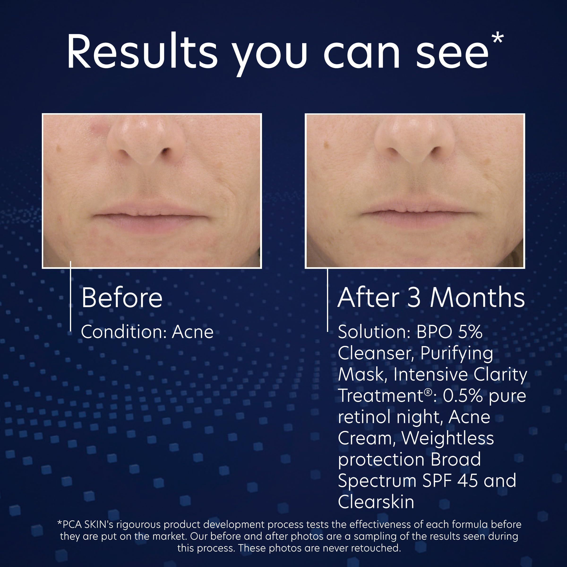 PCA SKIN gluconolactone moisture visual emphasizes hydrating cleanse after washing.