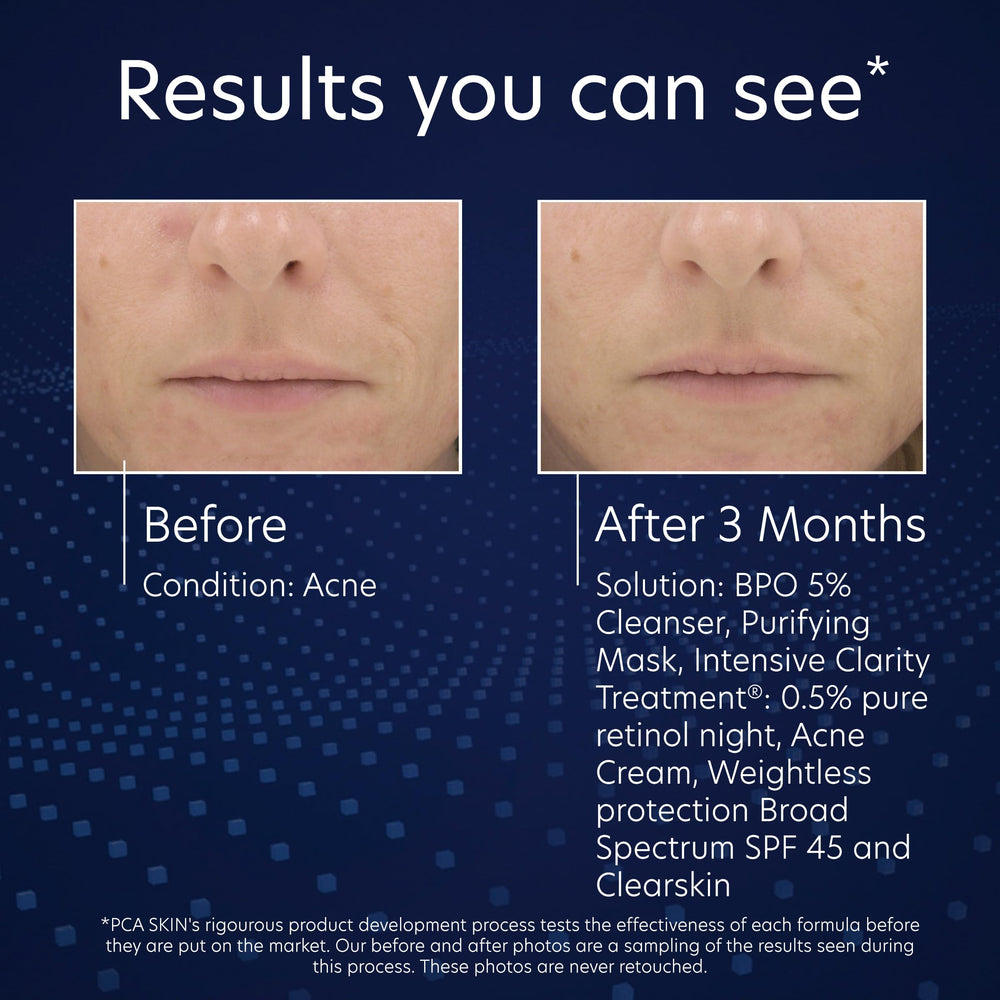 PCA SKIN gluconolactone moisture visual emphasizes hydrating cleanse after washing.
