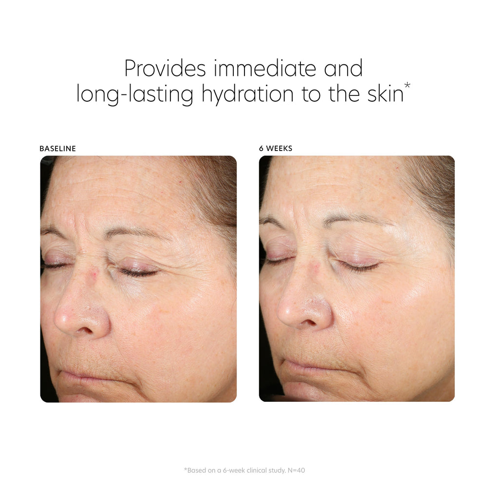 PCA SKIN Hyaluronic Acid Serum Ceramides reinforcing the moisture barrier