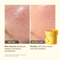 P.CALM Turmeric Bubble Mask carbonated action photo emphasizes bubbly cleanse.