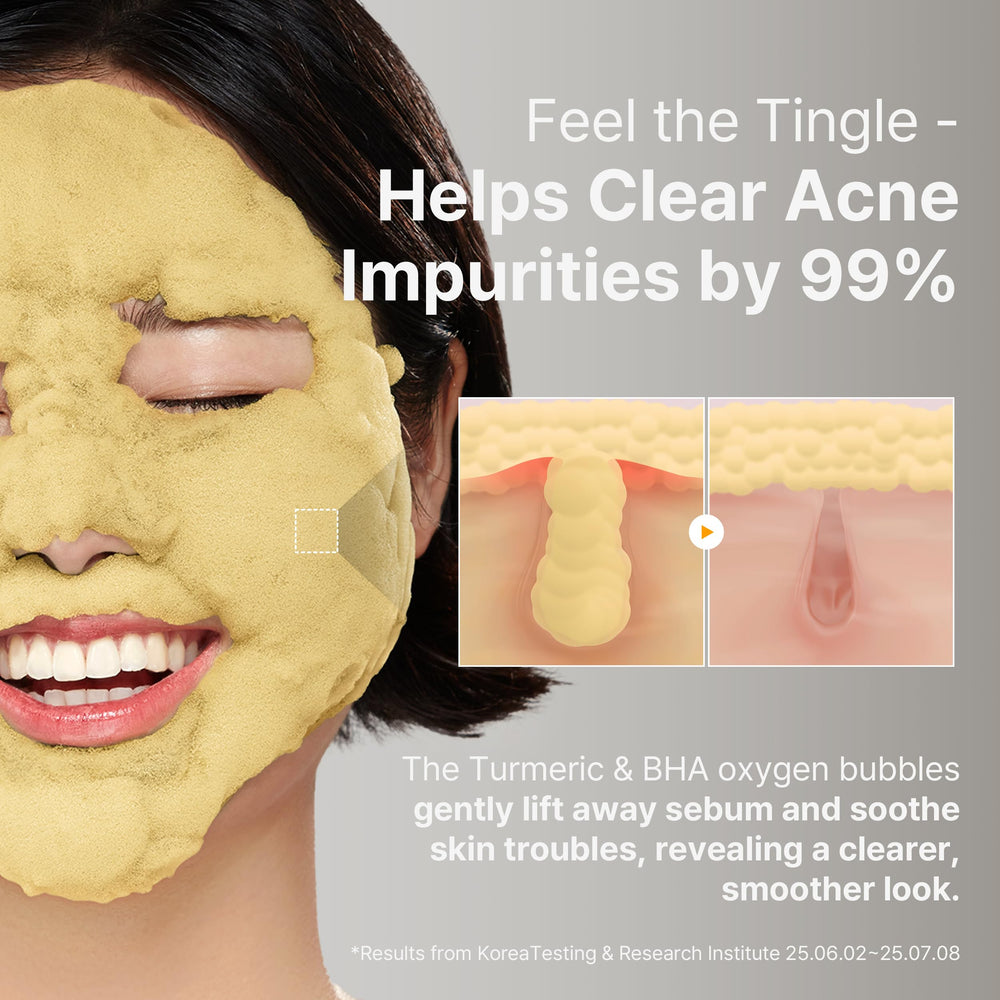 P.CALM gentle formula visual underscores suitability for sensitive or acne-prone skin.
