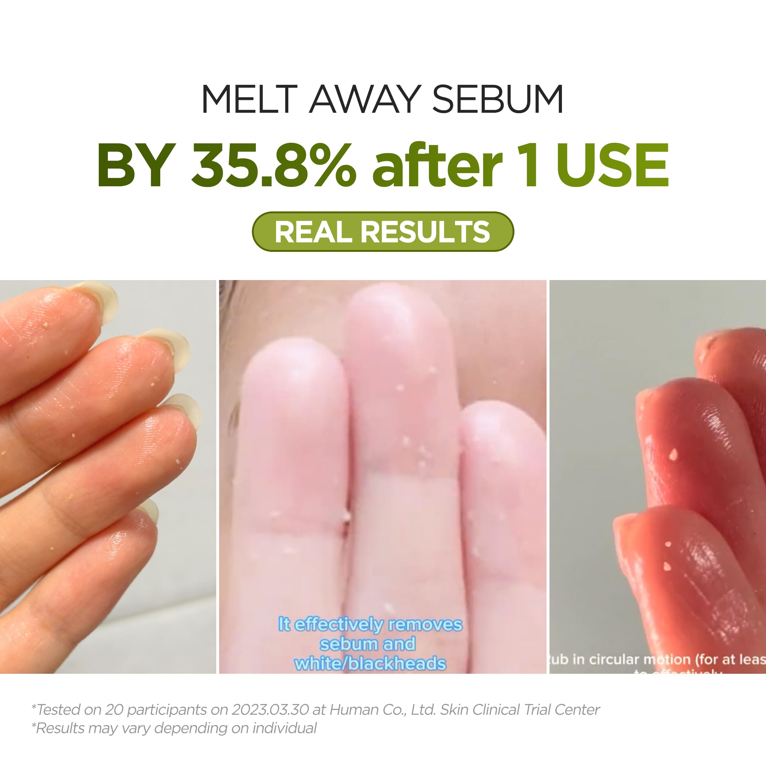 P.CALM Underpore cleansing oil emulsifies with water for makeup removal ease.