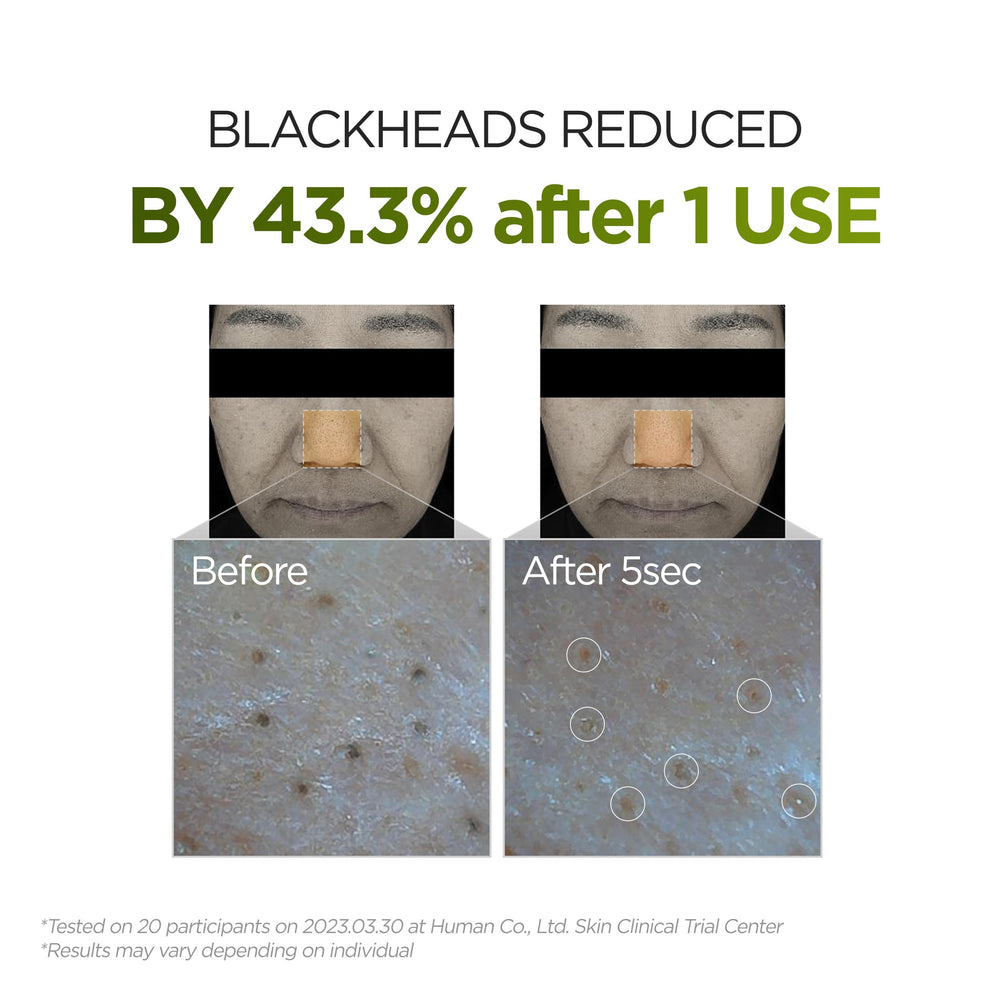 P.CALM Underpore lightweight emulsion glides across skin without heaviness.