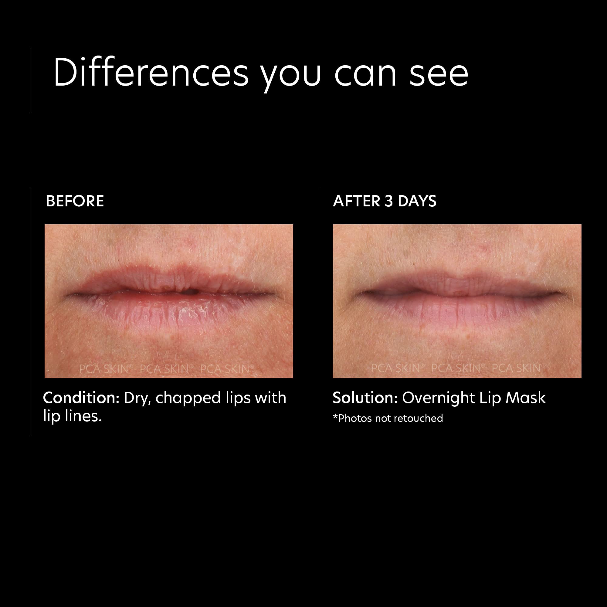 PCA SKIN Overnight Lip Mask featuring shea butter for lip softness