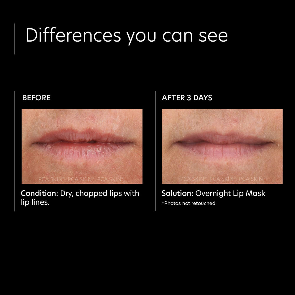 PCA SKIN Overnight Lip Mask with Vitamin E for antioxidant protection