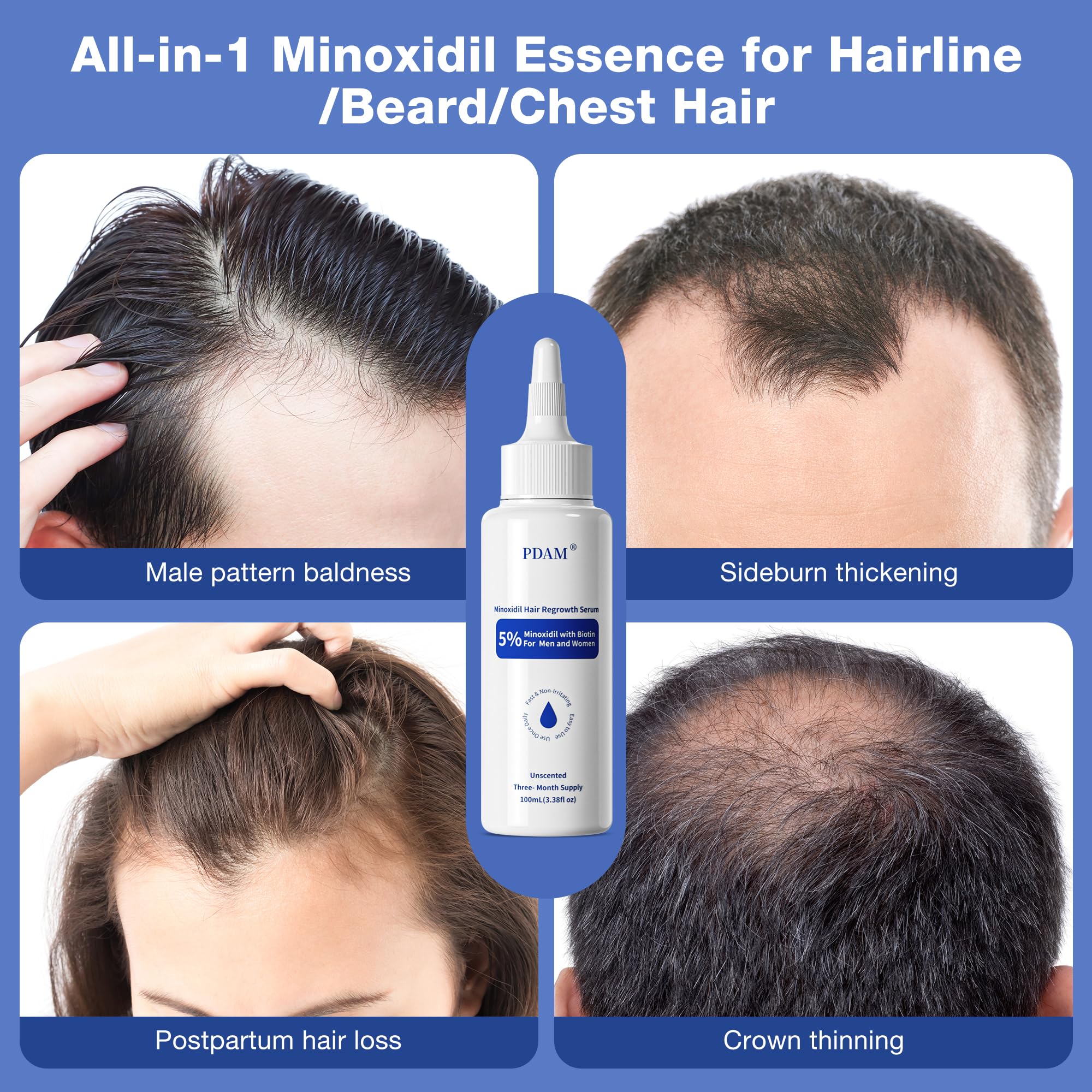 Pdam Minoxidil after-use massage on scalp showing gentle application routine.