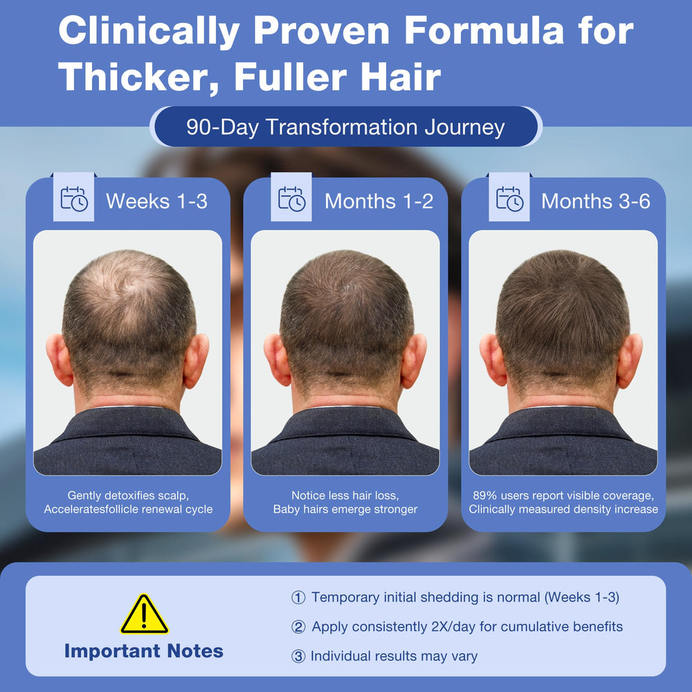 Pdam Minoxidil close-up of dense hair to highlight improved density.