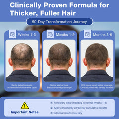 Pdam Minoxidil close-up of dense hair to highlight improved density.