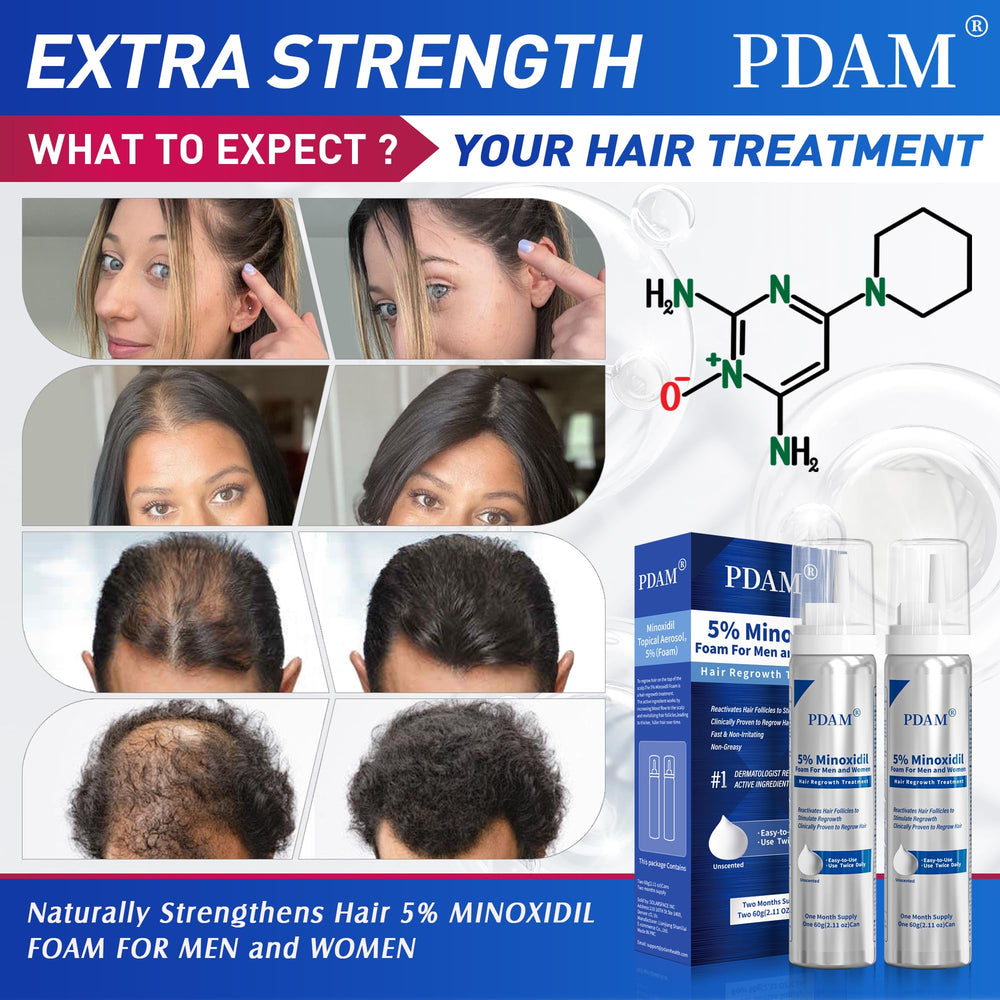 Pdam minoxidil-foam-men-women-use demonstrates universal hair support for thinning areas.